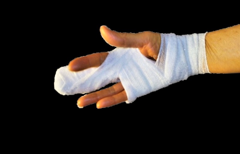 Hand meiner Schwester Gertrud nach der Fingeroperation 2021 / R. H.